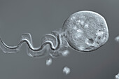 Vorticella sp. protozoa, light micrograph