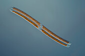 Pennate diatom, light micrograph