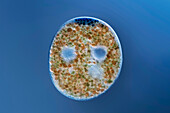 Nassula sp. protozoa, light micrograph