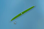Green alga and diatom, light micrograph