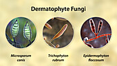 Dermatophyte fungi, illustration