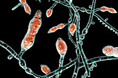 Microsporum audouinii fungus, illustration