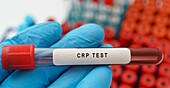 C-reactive protein blood test, conceptual image
