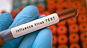 Influenza virus test, conceptual image