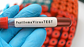 Papillomavirus test, conceptual image