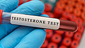 Testosterone blood test, conceptual image