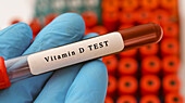 Vitamin D test, conceptual image