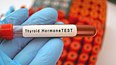 Thyroid blood test, conceptual image