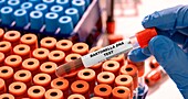 Bartonella DNA blood test, conceptual image