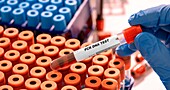 PCR DNA blood test, conceptual image