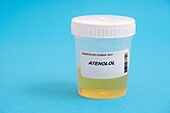 Urine test for atenolol