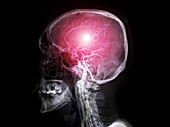 Cerebral arteries, MRI angiogram