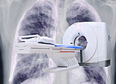 CT scanning, composite image