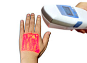 Hand veins shown by infrared finder