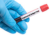 Cryptococcal antigen test, conceptual image