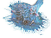 Peri-implant junctional epithelium cell, SEM