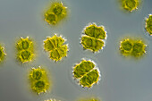Staurastrum forficulatum algae, light micrograph