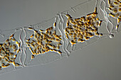 Mediopyxis helysia algae, light micrograph