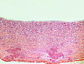 Artery wall, light micrograph