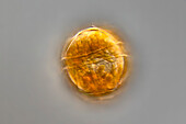 Peridinium cinctum, algae, light micrograph