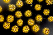 Synura sp. algae, light micrograph