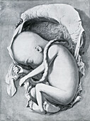 Foetus 6 months, illustration
