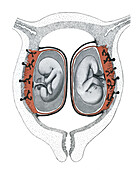 Twin foetuses, illustration