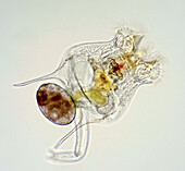 Freshwater rotifer, light micrograph