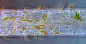 Microalgae settled on Lemna sp. root, light micrograph