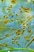 Gomphonema diatoms, light micrograph