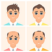 Male alopecia stages, illustration