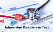 Adenosine deaminase test, conceptual image