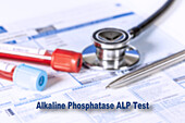 Alkaline phosphatase test, conceptual image