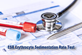 Erythrocyte sedimentation rate test, conceptual image