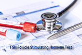 Follicle stimulating hormone test, conceptual image