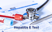 Hepatitis E test, conceptual image