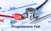 Progesterone test, conceptual image
