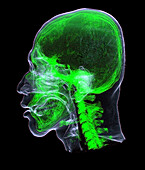 Head and neck, CT scan