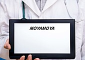 Moyamoya, conceptual image