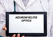 Neuromyelitis optica, conceptual image