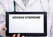 Noonan syndrome, conceptual image