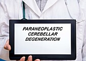 Paraneoplastic cerebellar degeneration, conceptual image