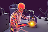 Carpal tunnel syndrome in laboratory workers, illustration