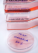 Researching insecticides used for malaria control