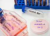 Testing for malaria, conceptual image