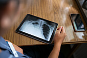 Digitales Tablet mit Röntgenbild