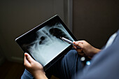 Hands holding digital tablet showing X-ray