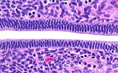 Uterus lining gland cells, light micrograph