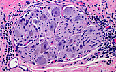 Ganglion nerve cells, light micrograph