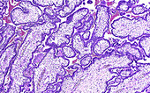 Placental villi, light micrograph